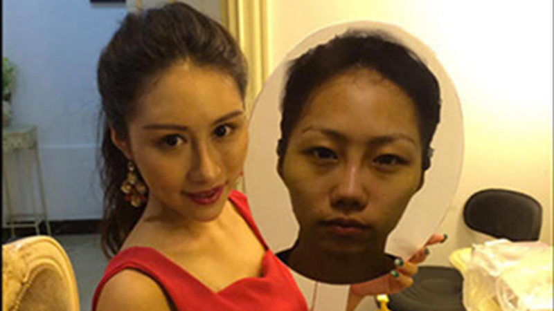 Illustration for article titled Intense Photos of Plastic Surgery Tranformations Going Viral in China